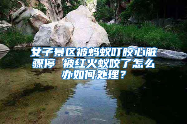 女子景區被螞蟻叮咬心臟驟停 被紅火蟻咬了怎么辦如何處理？
